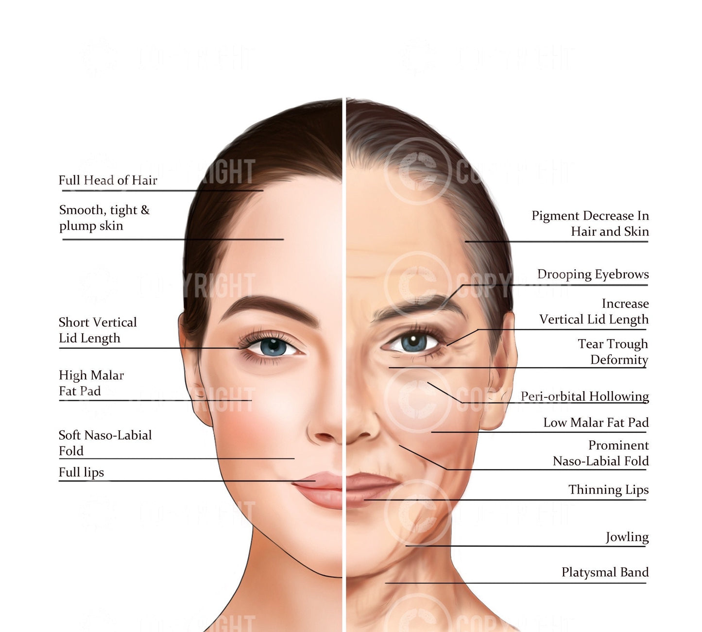 Bundle | Ageing of the Face and Neck | Botox & Filler Injector | Anatomy | Poster | Aesthetics | Dermatology | Medspa| Digital Download