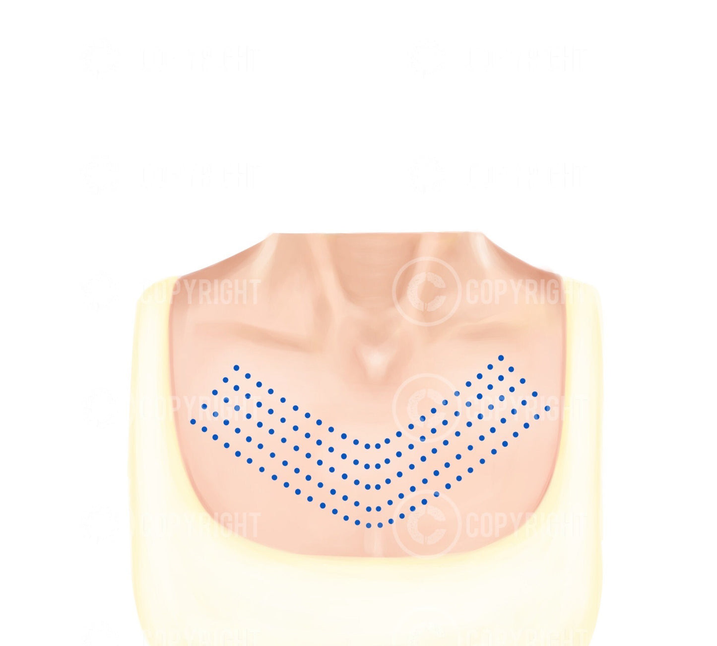 Mesotherapy injection patterns | Botox & Filler Injector | Anatomy | Poster | Aesthetics | Dermatology | Medspa| Digital Download