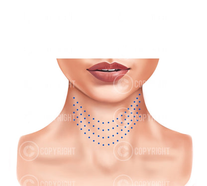 Mesotherapy injection patterns | Botox & Filler Injector | Anatomy | Poster | Aesthetics | Dermatology | Medspa| Digital Download