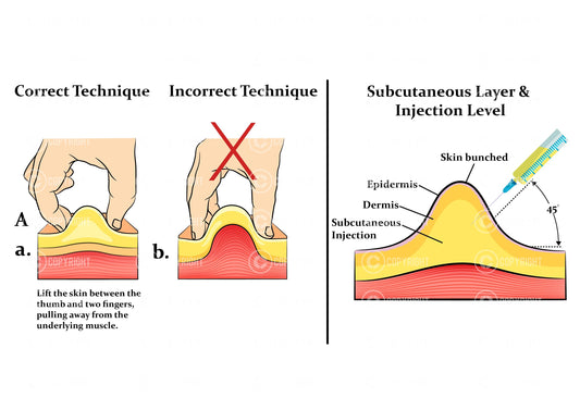 Subcutaneous injection technique | Fat Dissolving |Botox & Filler Injector | Anatomy | Aesthetics | Dermatology | Medspa| Digital Download