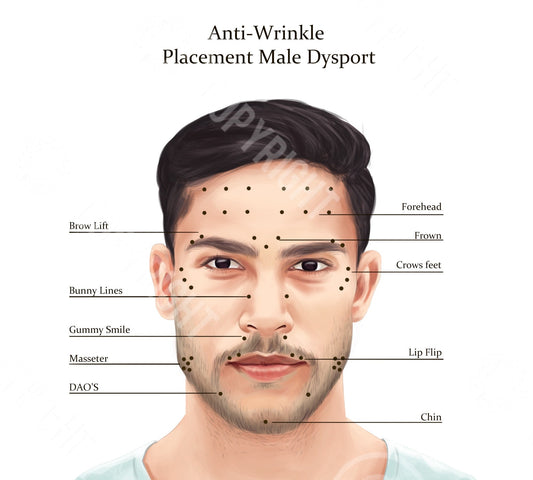 Male Dysport Injection Points | Botox & Filler Injector | Anatomy | Poster | Aesthetics | Dermatology | Medspa| Digital Download