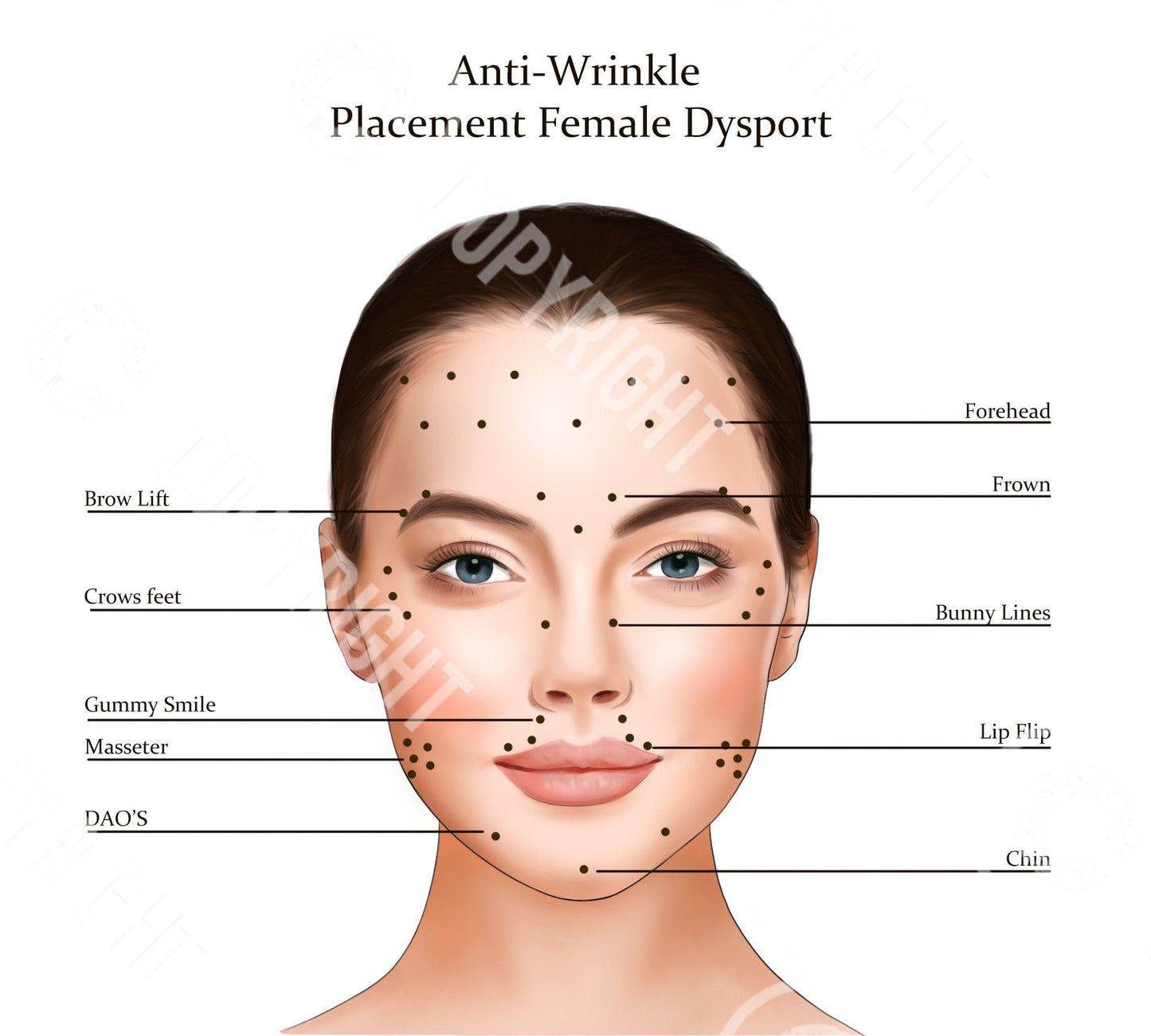 Dysport Injection Points | Botox & Filler Injector | Anatomy | Poster | Art | Aesthetics | Dermatology | Medspa| Digital Download