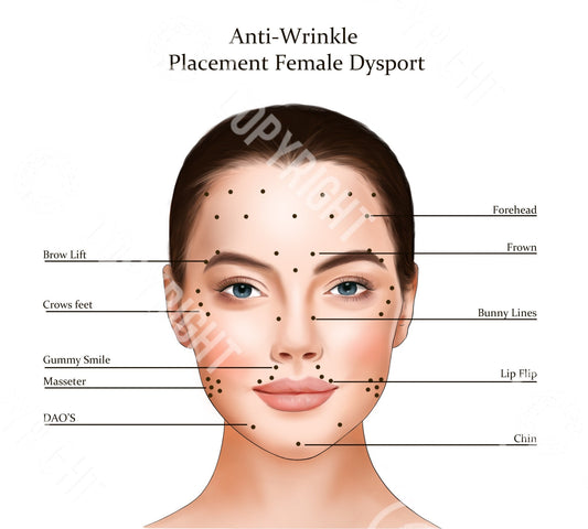 Dysport Injection Points | Botox & Filler Injector | Anatomy | Poster | Art | Aesthetics | Dermatology | Medspa| Digital Download