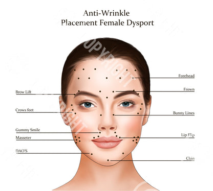 Dysport Injection Points Bundle | Botox & Filler Injector | Anatomy | Poster | Art | Aesthetics | Dermatology | Medspa| Digital Download