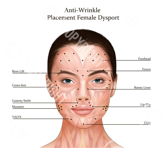 Dysport Injection Points on Muscle Anatomy | Botox & Filler Injector | Anatomy | Art | Aesthetics | Dermatology | Medspa| Digital Download