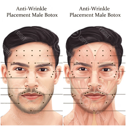 Male BOTOX Injection Points Bundle | Botox & Filler Injector | Anatomy | Poster | Aesthetics | Dermatology | Medspa| Digital Download