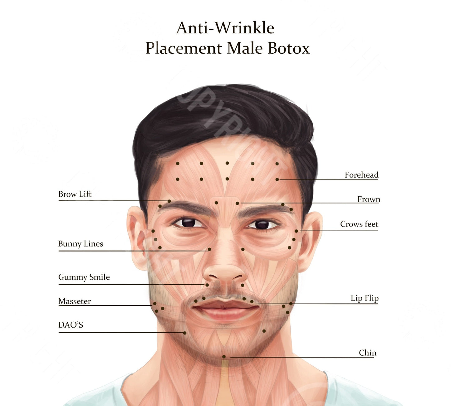 Male BOTOX Injection Points Bundle | Botox & Filler Injector | Anatomy | Poster | Aesthetics | Dermatology | Medspa| Digital Download