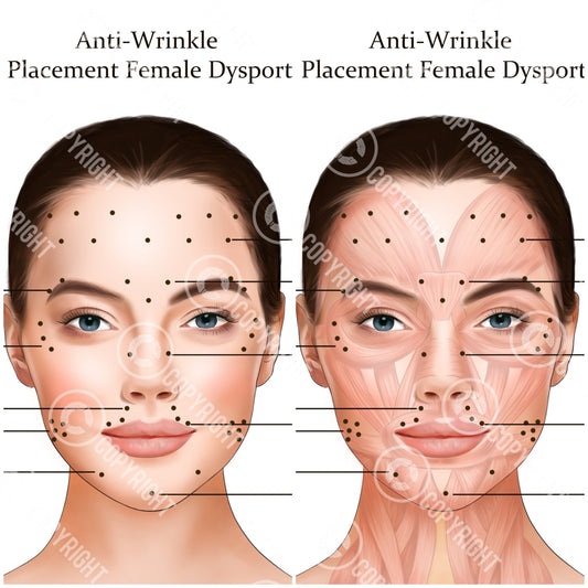 Dysport Injection Points Bundle | Botox & Filler Injector | Anatomy | Poster | Art | Aesthetics | Dermatology | Medspa| Digital Download