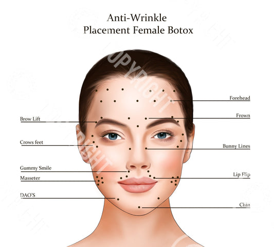 Botox Injection Points | Botox & Filler Injector | Anatomy | Poster | Art | Aesthetics | Dermatology | Medspa| Digital Download