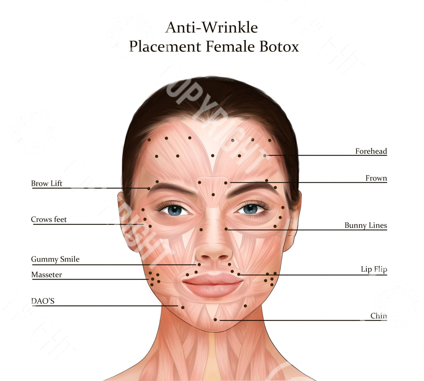 Botox Injection Points Bundle | Botox & Filler Injector | Anatomy | Poster | Art | Aesthetics | Dermatology | Medspa| Digital Download