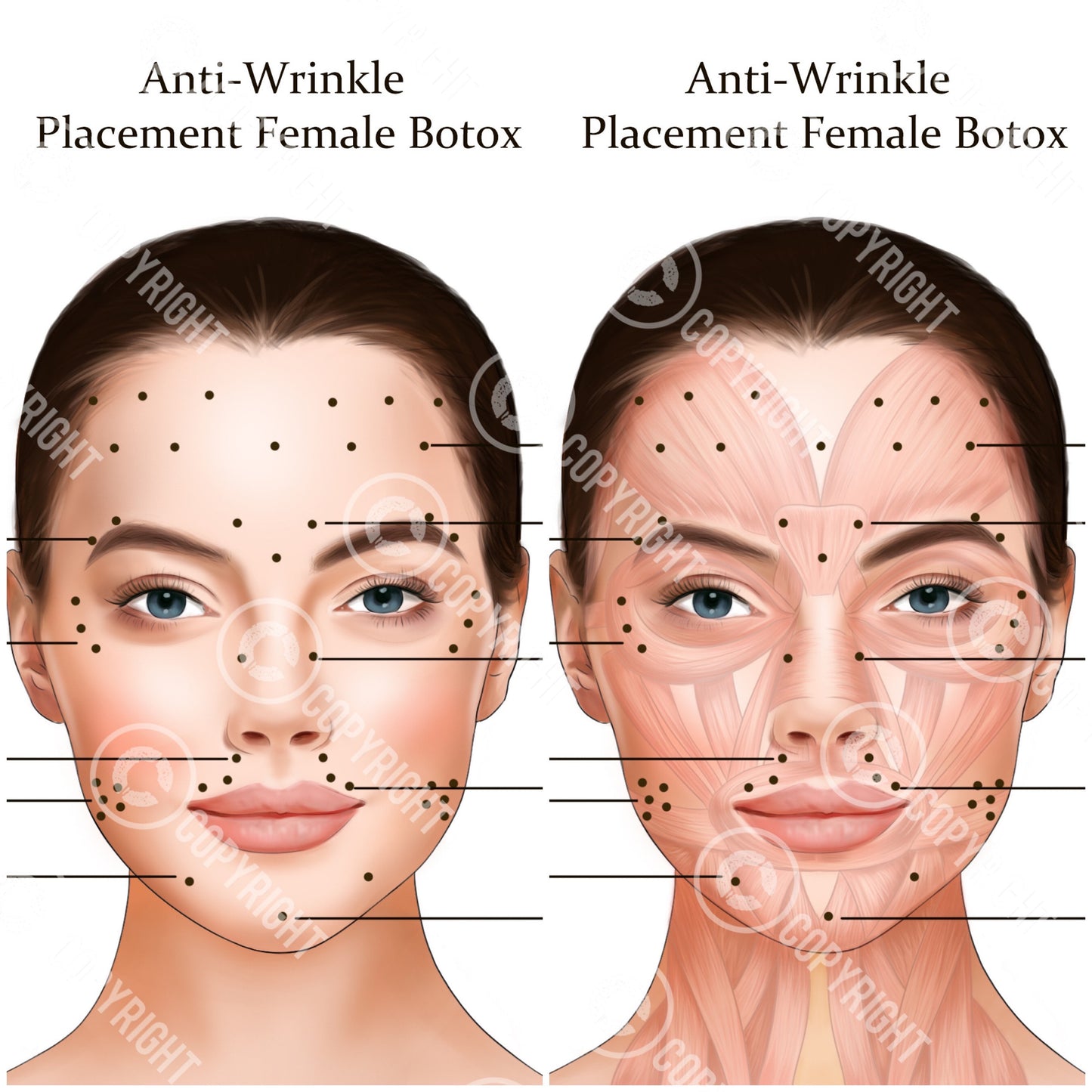 Botox Injection Points Bundle | Botox & Filler Injector | Anatomy | Poster | Art | Aesthetics | Dermatology | Medspa| Digital Download